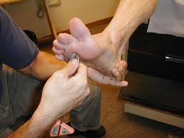 Image result for Babinski Reflex