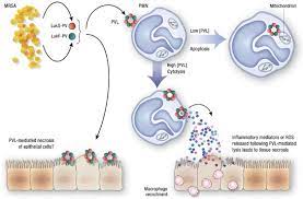 We aimed to examine the epidemiology of pvl in clinical mssa isolates from patients presenting to auckland city. Community Acquired Methicillin Resistant Staphylococcus Aureus The Role Of Panton Valentine Leukocidin Laboratory Investigation