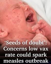 A Far North pharmacist has urged more Queenslanders to get vaccinated  against measles following Cairns being identified as “ground zero” for an  outbreak in August. ➡️ https://bit.ly/4nw3QiP