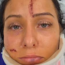 Fundraiser by Jaclyn Smith : Help Support a Family after a Severe Car Crash.