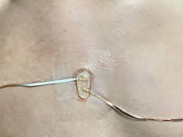 Image result for Sweat Chloride