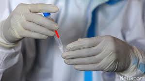 7 Poin Surat Edaran Kemenkes Yang Mengatur Harga Rapid Test Antigen