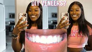 We recommend that you undertake this procedure from a qualified dentist and selecting a durable material. Diy Veneers Perfect Teeth Hack Skai Beauty Youtube