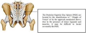 Palpation Of Posterior Superior Iliac Spine Download Scientific Diagram