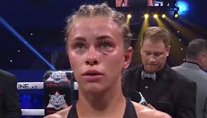 She is currently associated with bare knuckle fighting championship (bkfc. Paige Vanzant Issues Statement Following Loss To Rachael Ostovich At Bkfc 19 Bjpenn Com