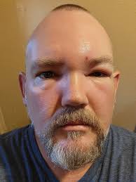 Will Bti bacteria harm bees in birdbaths?