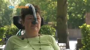 Work And Disability Nhs
