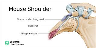 The scapula is a flat, triangular bone that forms the posterior part of the shoulder girdle. Mouse Shoulder A Painful Ailment For Pc Gamers Esports Healthcare