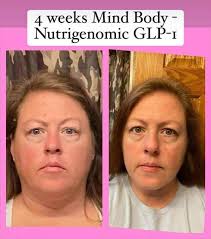 Understanding the root causes of weight gain and natural solutions