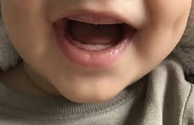 In welcher reihenfolge kommen die ersten zähne? Die Ersten Zahne Vom Zahneinschuss Bis Zum Durchbruch April 2017 Babyclub Seite 14 Babycenter