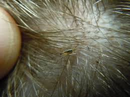 The hair coloring techniques, such as ombre and balayage are on the rise while the good old highlights are not all out of the picture. What Do Lice Look Like The Video Is Kinda Gross But Necessary