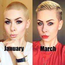 From A Buzzcut To An Undercut Pixie In Under 2 Months Undercut Pixie Growth Hair Buzzcut Nanna Head Hair Growth Really Short Hair Growing Short Hair