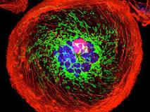 Image result for what doctordesigns treatment for breast cancer