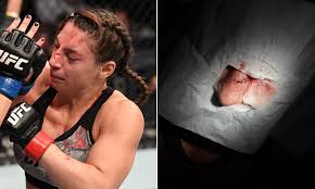 In an early prelim, a surging miranda maverick squares off against liana jojua in the womens' flyweight division. Ufc 254 Dana White Shares Images Of Liana Jojua S Horrific Nose Injury Picked Up In Loss Daily Mail Online