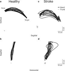 Image result for Finger-Nose-Finger Test