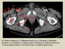 This article reviews the anatomical and functional information of the gastrocnemius muscle, its embryological derivation. Presentation1 Pptx Ct Normal Anatomy Of The Abdomen And Pelvis