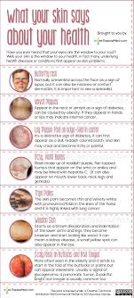 What Your Skin Tells About Your Health Health Disease Health And Nutrition Health Fitness
