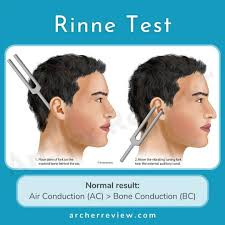 Image result for Tuning Fork Test