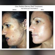 pearl stringer near me