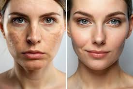 Interpreting Client Measurements for Tailoring