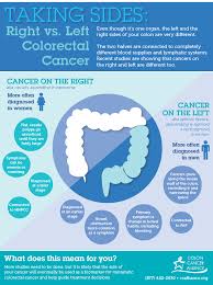 Pin On Colon Cancer