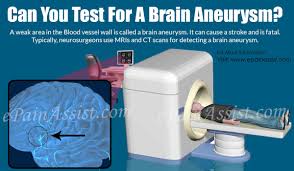 Can You Test For A Brain Aneurysm Often aneurysms are found by chance during tests done for other reasons.