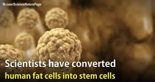 Pacienții români au acces la unități de celule stem (din sînge ombilical. Forum Pro Stem Cell Celulele Stem Boli Colectare Preturi 3 3