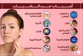 طرق علاج حب الشباب في المنزل