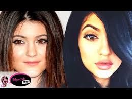 Kendall jenner inspired us all to update our summer wardrobes when we spotted her frolicking while kendall played around her sisters kylie jenner, khloe kardashian and kim kardashian treated. Kylie Jenner Before After Plastic Surgery Youtube