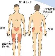 若要选择默认打印机，请选择开始按钮 ，然后选择设置。 转到设备>打印机和扫描仪> 选择打印机 >管理。 然后选择设为默认设备。 如果你选中了让 windows 管理默认打印机，则需要先取消选中，然后才能自行选择默认打印机。 在 windows 10 中，默认打印. è‚Œè‚‰æ³¨å°„éƒ¨ä½ä½ç½®å›¾è§£ æœç‹—å›¾ç‰‡æœç´¢