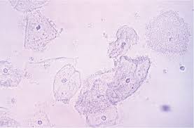 Rubber is often glued to another material as a protective barrier to prevent slipping and other problems. Vaginitis Diagnosis And Treatment American Family Physician