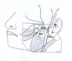 Image result for Ear Nerve Block