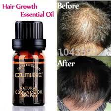 Inside, a hairstylist, an essential oil expert, and a dermatologist share how to use essential oils like rosemary oil and lavender oil for hair growth. Hair Loss Products Natural With No Side Effects Grow Hair Faster Regrowth Hair Grow Hair Faster Hair Regrowth Natural Hair Oils