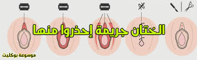 الطهارة شكل الختان الصحيح للذكور