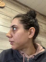 Hi everyone. I have been dreaming of plastic surgery