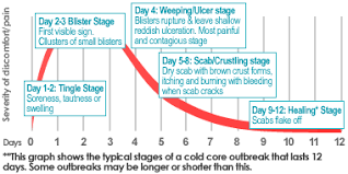 It shows some success in soothing cold sores and helping them heal faster. What Is A Cold Sore