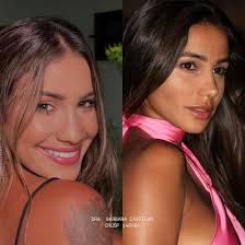 Alguém com saudade de ver um narizinho por aqui? 👃🏼🥰 Ponta mais fina e  empinada, um nariz mais delicado, do jeitinho que a paciente me pediu,  graças à Rinomodelação Estruturada 😮‍💨🤌🏼 O