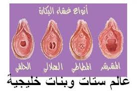 عالم ستات وبنات لون دم البكارة مكان غشاء البكر بالصور شكل غشاء بكارة سليم طريقة فض غشاء البكرة عند الفتاة