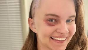 Fundraiser by Julie Sechrist : Support Amy's Battle Against Brain Cancer