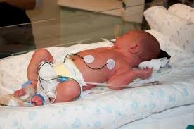 Iam 34 weeks pregnant my baby weight is 3kgs is it ok? Bryson Born At 34 Weeks Weight 4 Pounds 13 Oz Length 16 5 Babycenter