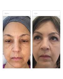 Alice Lawrence (@skincare_by_alice) • Instagram photos and videos