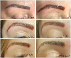 Inside, two dermatologists and a tattoo artist explain the tattoo healing stages, plus tattoo healing tips the takeaway. Saline Tattoo Removal Healing Process Tattoo