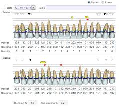 Periodontal Charting Dental Software Uk Software 4 Dentists