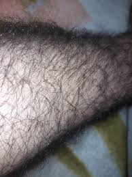 Hello, Not a dad but I need some advice from the dads out there, Im a 15  year old boy who has wayyy too much body hair and is super insecure about