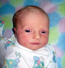 Birth, Hoffschneider