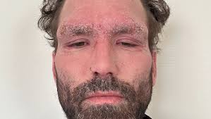 Fundraiser for Thomas Hoy by Alexis Fehling : Support Thomas's Journey to  Recovery in Bangkok