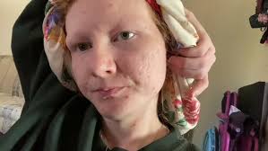 The Annie Beaton Project