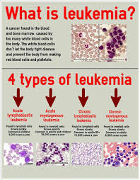 Www Usmle Usmle Org 4 Different Types And Their Description Assess Some Symptoms Also Medical Laboratory Medical Laboratory Science Oncology Nursing