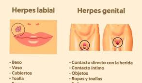 Maybe you would like to learn more about one of these? Ako Nakazit Opar A Ako Tomu Zabranit Vsetko O Vasom Zdravi