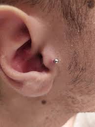 I Ve Had My Tragus Pierced For 3 Weeks And I Only Cleaned It With Water Bad Decision After I Saw This I Started Cleaning With Saline Solution And It S Been 4 Days
